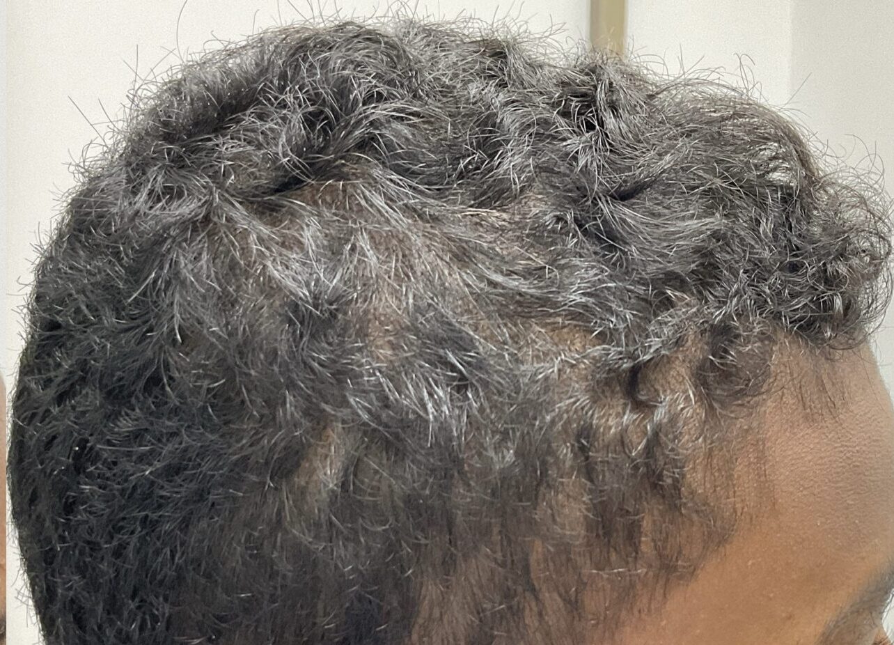 After